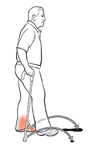 Side view of man using a cane. The arrows show where he should put his injured foot and cane to step past his other foot.
