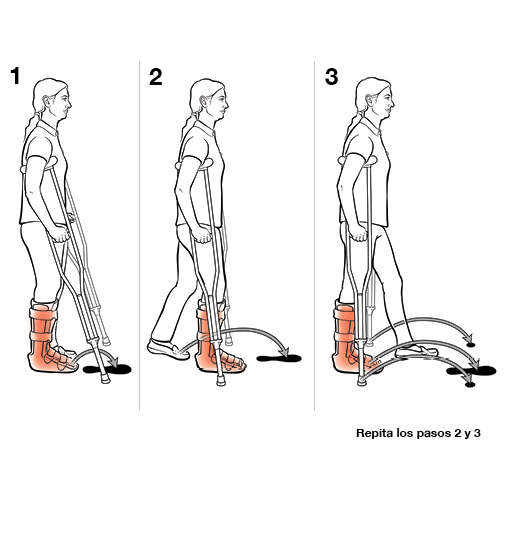 Tres pasos para usar muletas en las escaleras.