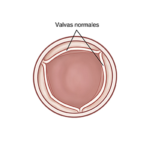 Vista superior de válvula pulmonar abierta con valvas normales.